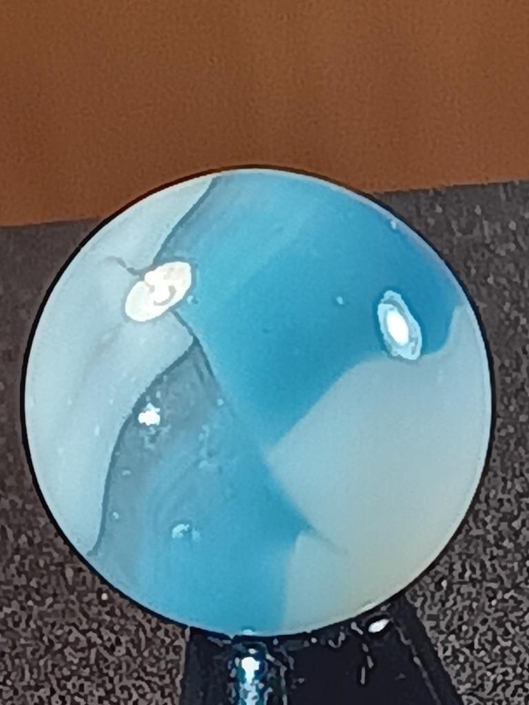 5/8″ Vitro Agate Sky Aqua Ice White on Clear Ribbon Patch NM Serious Marble B192